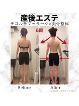 ミエル(Miel)/Before After