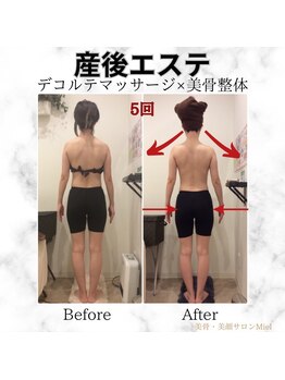 ミエル(Miel)/Before After