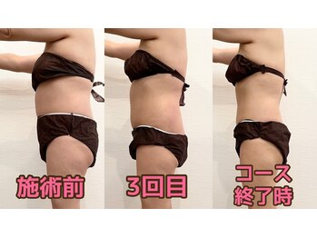みつば健康温活ダイエットエステサロン 大分店/お客さまのビフォーアフターです