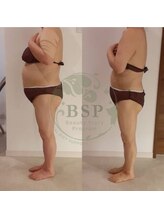 エステティックサロン ピュール ボーテ 東金店/食べて痩せる健康ダイエット