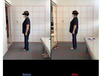 リード整骨院(LEAD整骨院)/肩こり、頭痛にお悩みの方