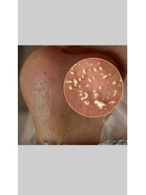 レンリー(Renry)/一度でもしっかり結果が出る！