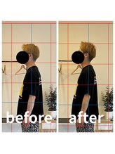 熊本カワル整体 JR上熊本駅院/巻き肩