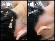 ステラマリス(STELLA MARIS)/うなじWAX脱毛