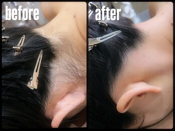 ステラマリス(STELLA MARIS)/うなじWAX脱毛