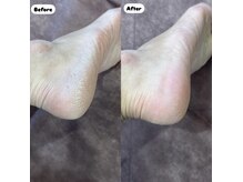 ネイルサロン ダイム(Dime)の雰囲気(つい触りたくなるかかとに♪足裏ガチガチさん大歓迎の足裏ケア☆)