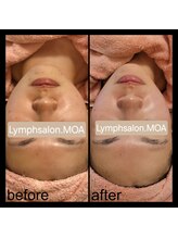 リンパサロン モア/13年の熟練技！韓国美肌WAX