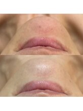 ウィンウィン 新山口店(Win Win)/ざらつき解消