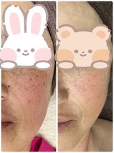 ギャラクシービューティー(galaxy beauty)/