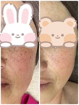 ギャラクシービューティー(galaxy beauty)/