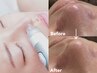 何度でもOK【つるんとタマゴ肌♪】毛穴洗浄（全顔）+鎮静/引き締めパック