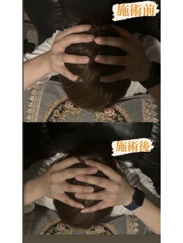 フィートウォーマー(Feet Warmer)/ビフォーアフター