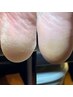 フットトータル角質ケアコース　¥9,000 ※ご新規の方は平日のみ可