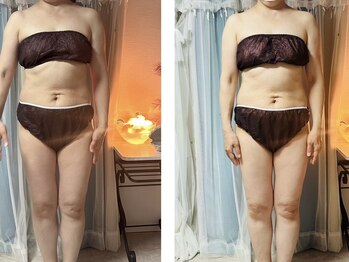 ヨサパーク ナナラーレア 福島店(YOSA PARK nanala lea)/痩身/ダイエット/リンパ/水素