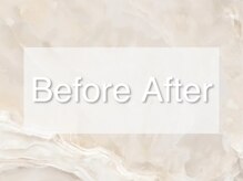 イデアルミー 大宮店(イデアルMe)/Before　Afterをご紹介します☆