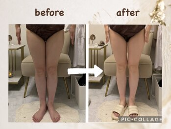 ラムール(L'amour)/痩せたい・サイズダウンしたい方