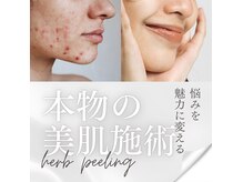天使の艶肌 武蔵小杉店の雰囲気（ハーブはやはり不動の人気！！）