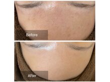 素肌研究所BSラボ/