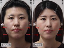 さつま骨格矯正 表参道青山院/歪み小顔矯正＋骨盤矯正