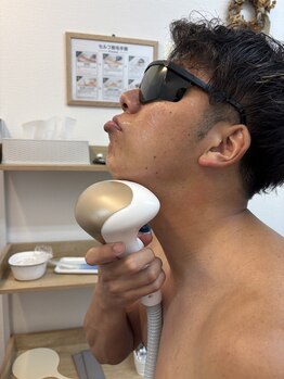 キングスサロン 熊本/お髭の処理が楽に！？