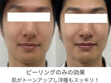 ブルーム(BLOOM)/男性もお肌のケアを！