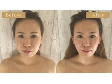頭蓋骨 小顔矯正サロン グレースフィオーレ 札幌店(gracefiore)/ビフォーアフター