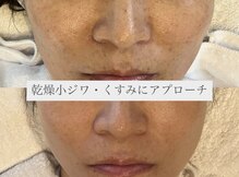 ミニマル(minimal)