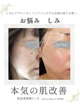 アルルプラス 南草津(ARuru+)/【肌改善】ビフォーアフター