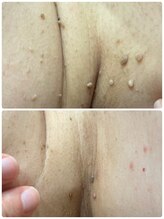 ギャラクシービューティー(galaxy beauty)/プラズマ