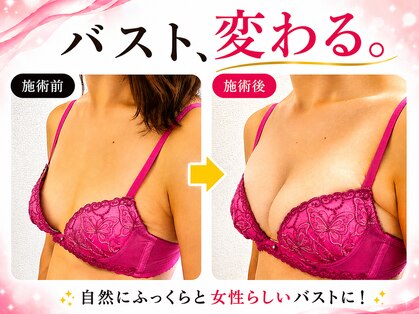 フェリス(Feliz)の写真