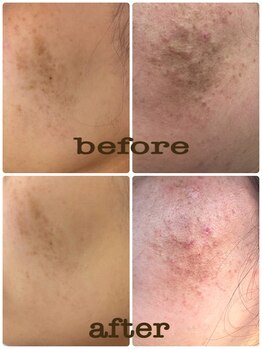 ブロン(Blanc)/いつまでも若く♪