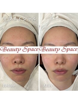 ビューティースペース 松戸店/