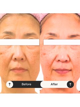 ゆう/何歳若返るの？