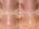 ニニ(nini)の写真