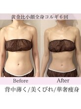 ピーチハート(Peach Heart)/黄金比小顔全身コルギ