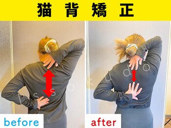 一息堂/20代女性「疲れが取れない」