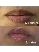 リュミエール デスポワール(Lumiere d'espoir)/ROMAPINK ローマピンク