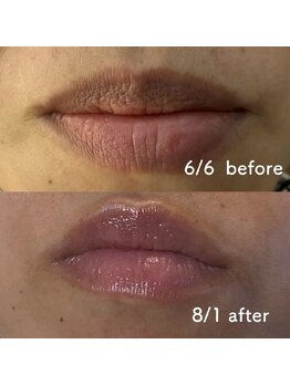 リュミエール デスポワール(Lumiere d'espoir)/ROMAPINK ローマピンク