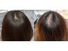 【ヒト幹細胞スパHSC60】髪の分け目やつむじが特に気になりはじめた方に