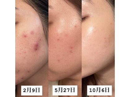 クレア(Claire)の写真