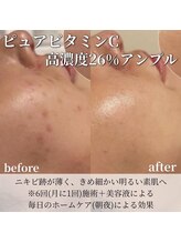 エムラボ 新宿店(M LABO)/イオン導入