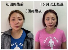 トータルバランス整体院  オレンジ(ORANGE)の雰囲気（小顔やアゴのズレ/顔の左右差/エラでお悩みの方の再来店が多数！）