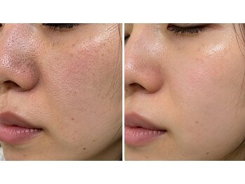ドクターマジックタッチ(Dr.MAGIC TOUCH)の写真/「ちゃんと洗ってるのに、なぜ？」黒ずみ・詰まり・ザラつく毛穴。隠したくなる肌から、見せたくなる素肌へ