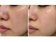 ドクターマジックタッチ(Dr.MAGIC TOUCH)の写真/「ちゃんと洗ってるのに、なぜ？」黒ずみ・詰まり・ザラつく毛穴。隠したくなる肌から、見せたくなる素肌へ