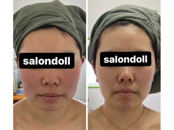サロンドール(SalonDoll)/人気クーポン