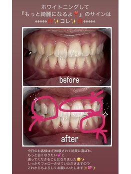 ホワイトニングビューティー 名古屋栄店(WHITENING BEAUTY)/セルフホワイトニング