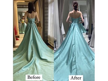 コルミチョン サロン(骨美整 salon)/ブライダル施術　Before・After