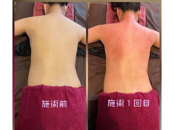 フェリーチェ(felice)/セル分解ビフォーアフター