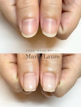 マリーロール 梅田店(Marie Laure)/自爪育成/深爪矯正/ネイルケア