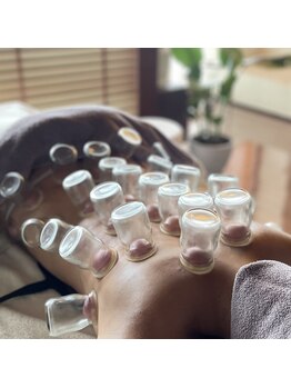 ウルル 福岡(Uluru)/肩・背中のカッピング